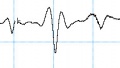 Effect of C4D frequency on peak shape, 250 kHz.jpg