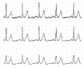 Figure 5. A signal with various low-pass filter settings.jpg