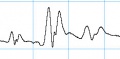 Effect of C4D frequency on peak shape, 1000 kHz.jpg